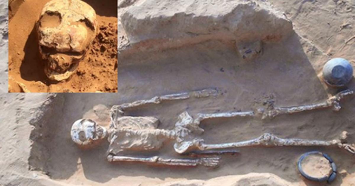 Burial Number 12 at Bogomolny, warrior with evidence of brain surgery by trepanning in skull. Inset, close up of trepanned skull  