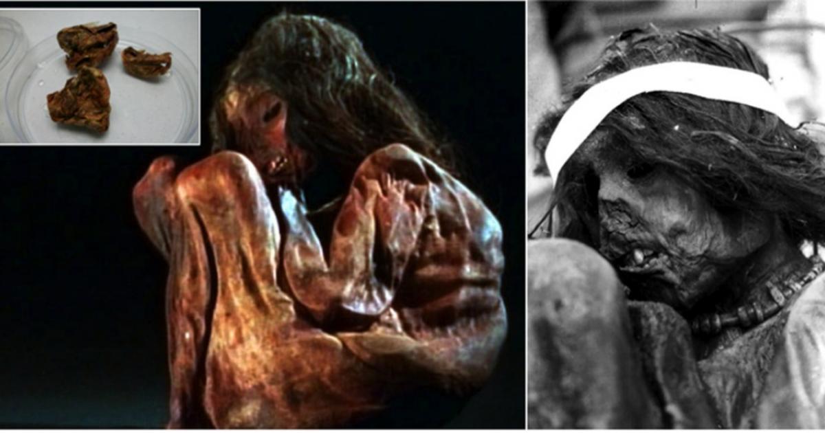 Photos of the child mummy that may have been sacrificed in a ritual of Capacocha. Above left, detail of the mummy’s dissected lung. A small sample of 350 milligrams (0.01 ounces) was used to extract DNA in the current study.