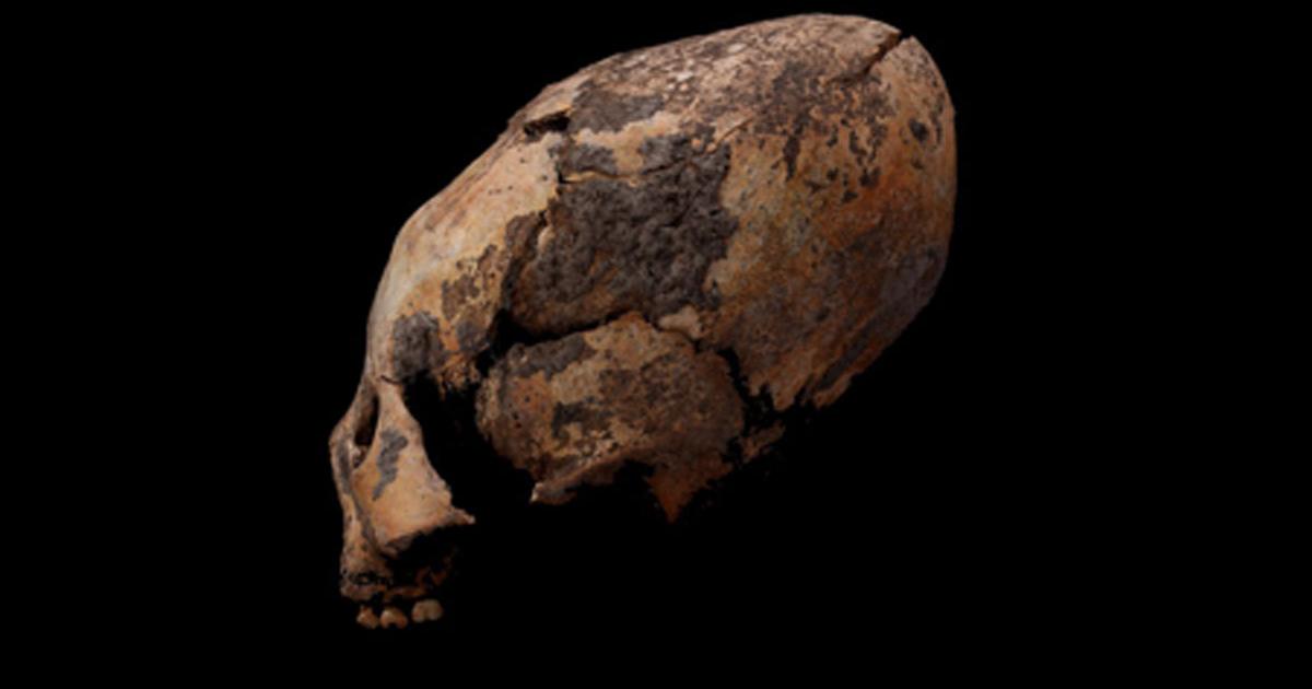 One of the oddly shaped human skulls discovered in northeastern China. Source: Q Wang / Fair Use.