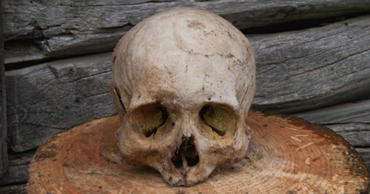 Human skulls have been found with evidence of craniotomy.