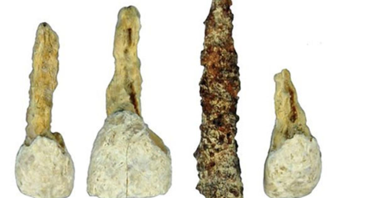 Dental implant in Iron Age burial chamber