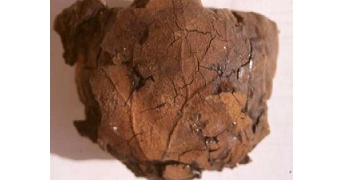 Egyptian mummy with peculiar skull containing brain imprint 