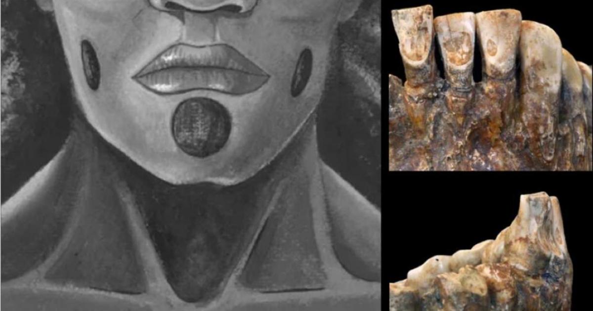 Teeth of OH1 (John C Willman) and the proposed facial piercings. (Lou-Octavia Mørch)