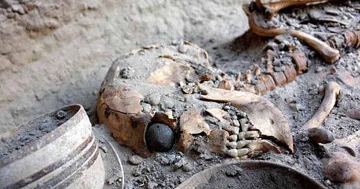 Rome’s National Museum of Oriental Art displayed the reconstructed face of a female skeleton which was found in Iran’s Burnt City wearing a fake eye. The museum closed in 2017 and its collections were transferred to the Pigorini National Museum of Prehistory and Ethnography in Rome.    
