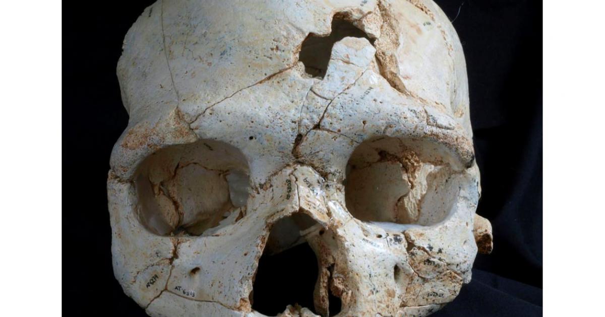 A frontal view of Cranium 17 showing the position of the traumatic events T1 (inferior) and T2 (superior).