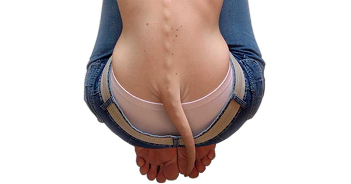 How (Most) Humans Lost Their Tails - From Fish to Tetrapods to Apes to Homo Sapiens