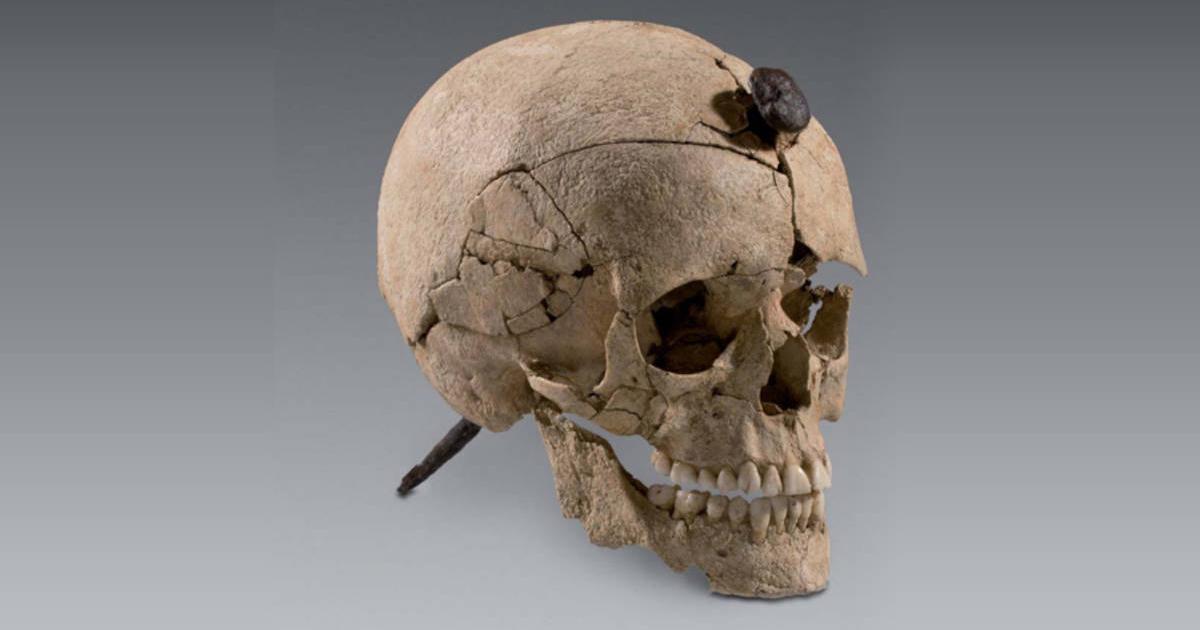 Iron Age Iberian skull with nail driven through its head, recovered by archaeologists at site in Ullastret, Spain.