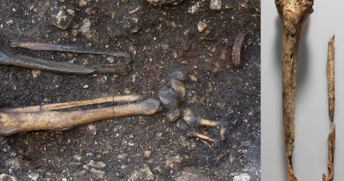 The knight’s left foot was amputated, as visible in this photo 