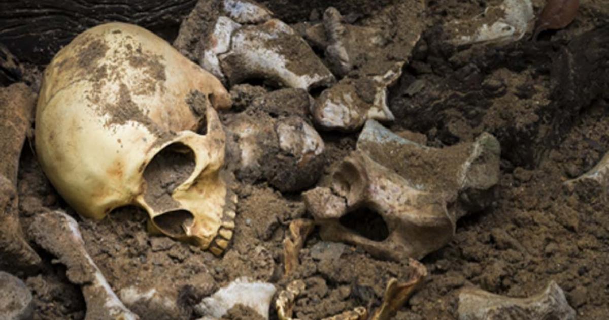 Experts have studied the skeletal remains of five bodies excavated in Ireland and tested the remains for strains of leprosy. Source: Suthiporn / Adobe Stock.