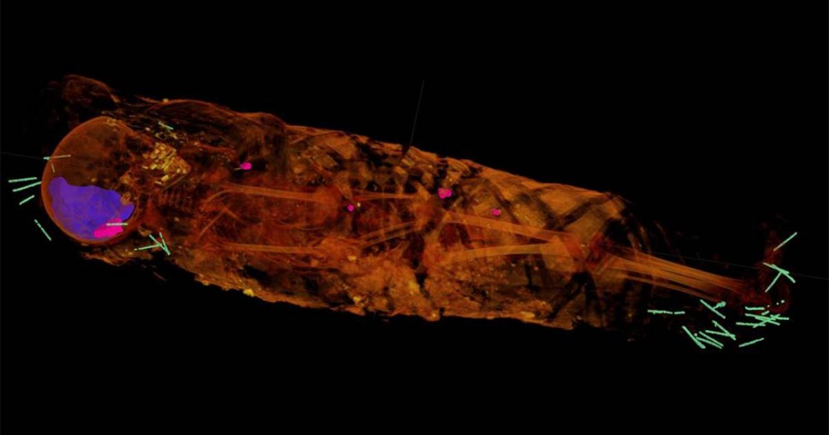 Tech Reveals A Little Girl Mummy Who Doesn’t Look Like Her Portrait