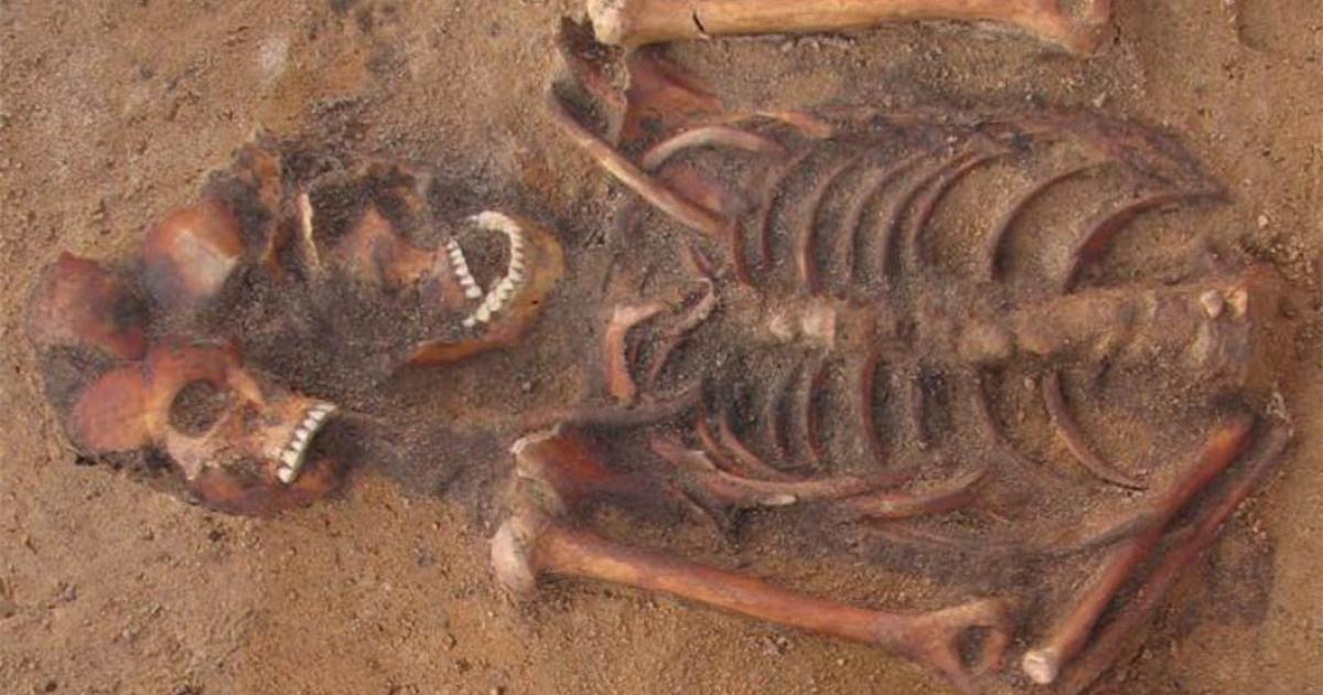 Multiple burial in Vilnius, Lithuania containing an individual infected with both plague and yaws. Source: Courtesy of Robertas Zukovskis and Scientific Reports.