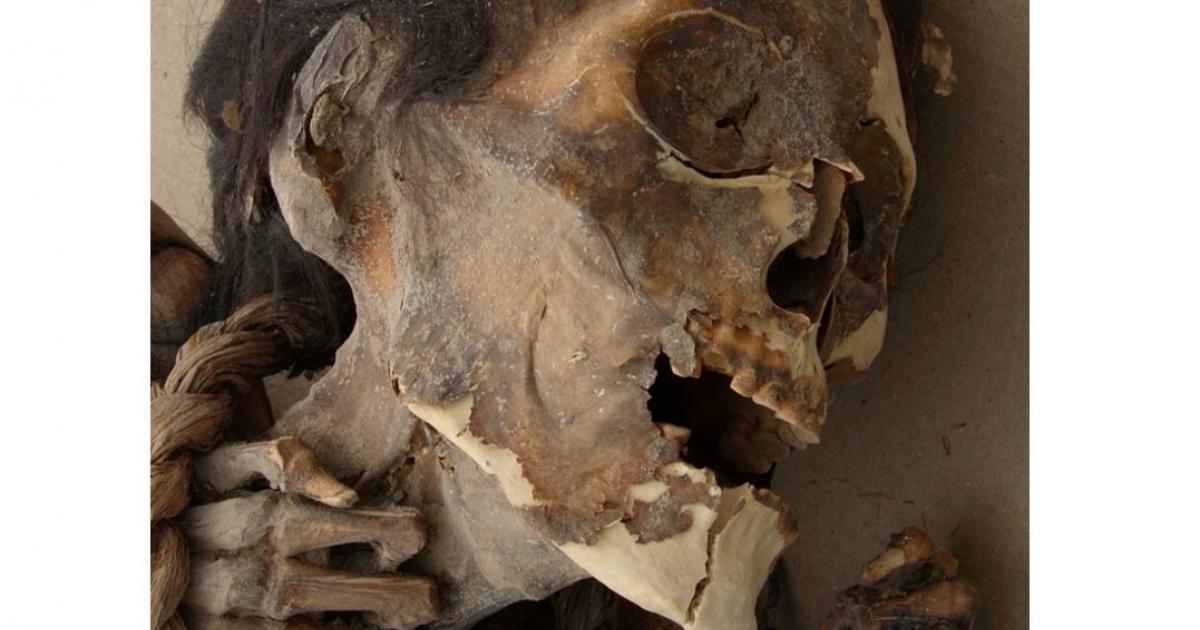 A mummy tested for arsenic poisoning.