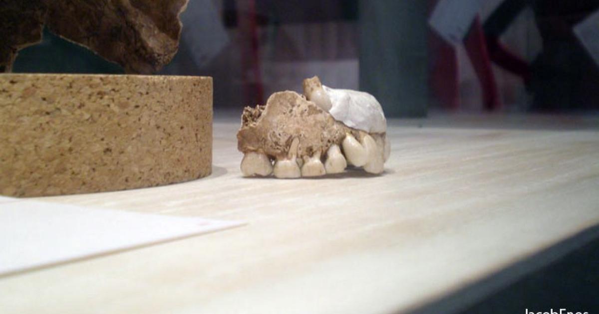 Neanderthal Teeth