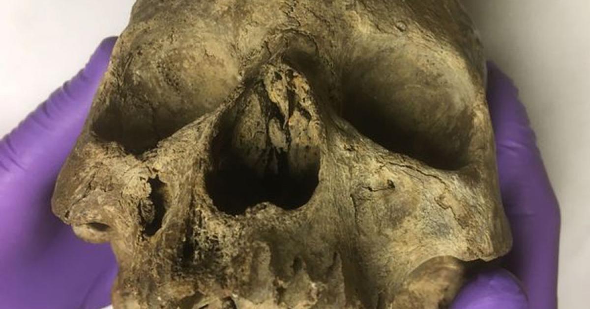 Greta’s skull was for the longest time viewed as the oldest British skull until it was carbon dated and proven to be a medieval skull. Source: David Adkins / DerbyShireLive