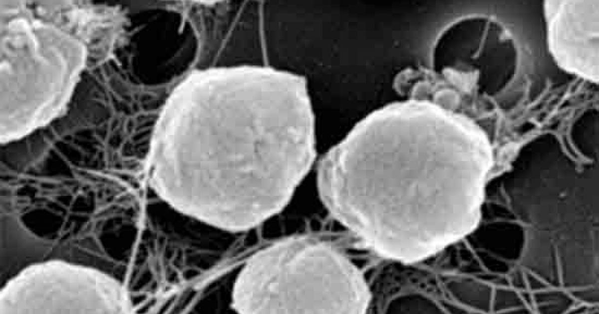 Life Origins - Organisms like Archaea