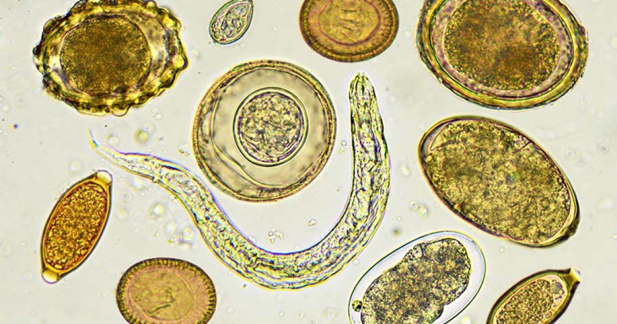 Selection of helminthes, or parasitic worms, under a microscope. Source: jarun011 / Adobe Stock