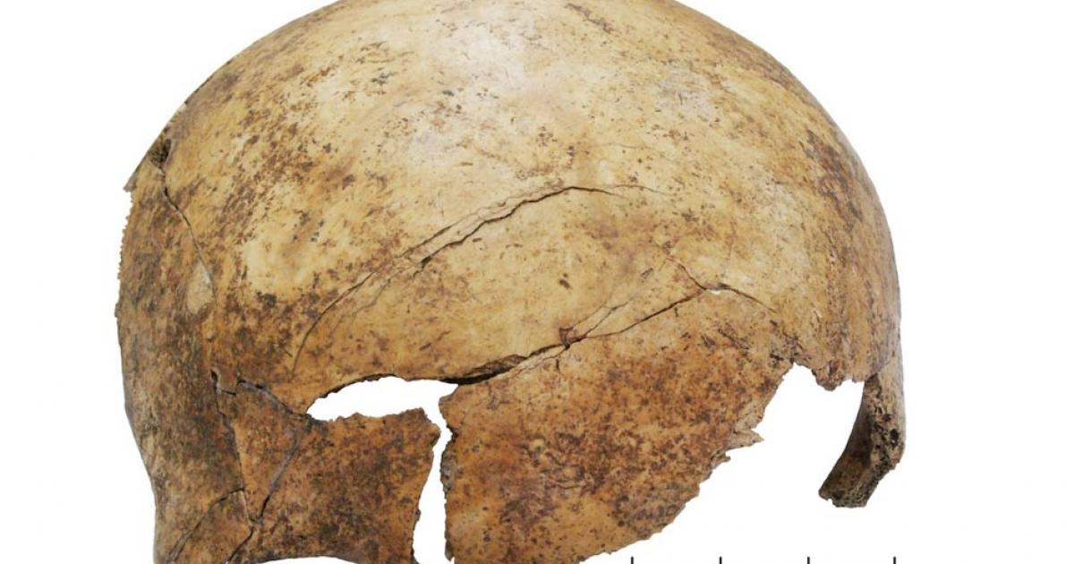 Profound cranial injuries on the frontal skull bone of a child approximately 8 years old. Other such injuries are evidence of a prehistoric massacre or torture at a mass grave at Schoeneck-Kilianstaedten, near Frankfurt, Germany. 