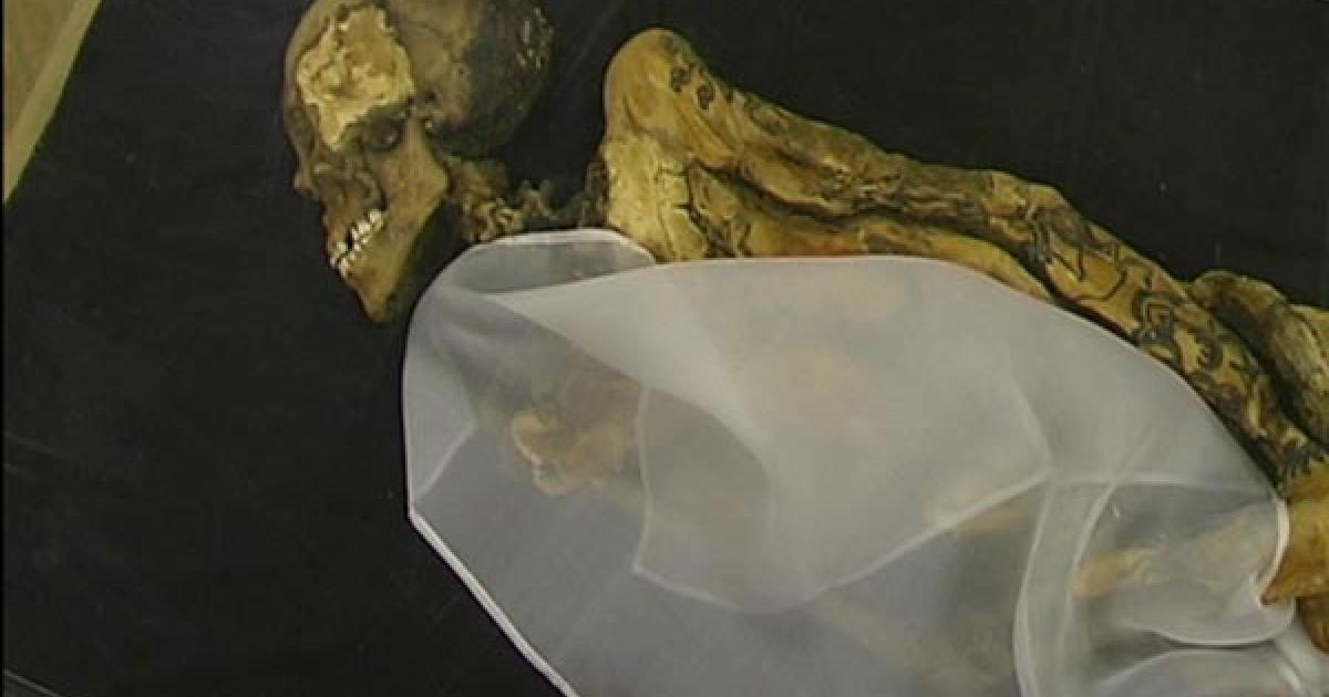 Ancient Siberian princess use cannabis to cope with breast cance