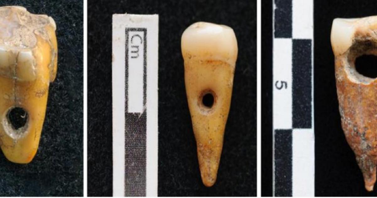Evidence of human tooth jewelry has been found at Çatalhöyük, Turkey. Source: SCOTT HADDOW / UNIVERSITY OF COPENHAGEN