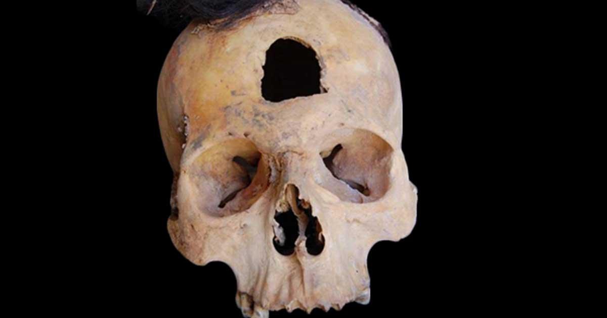 One of six trophy heads found in the 27 funerary pits. 