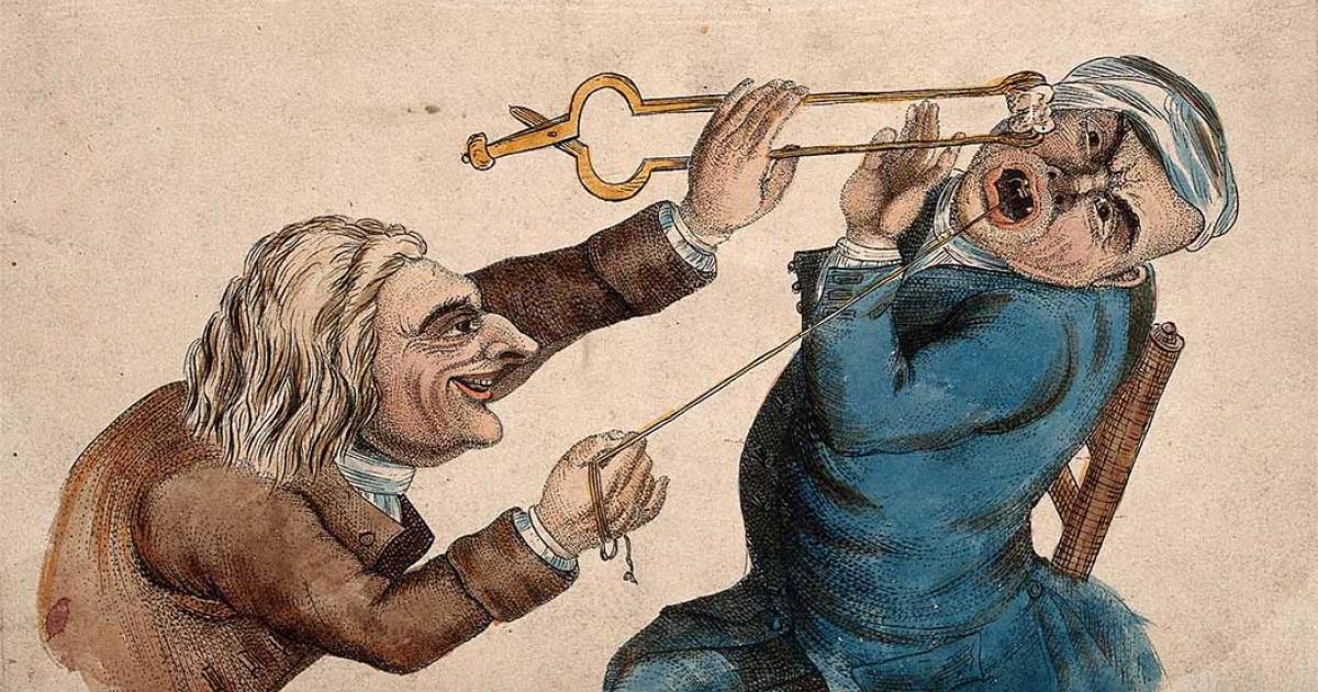 There are strange jobs, like cleaning toilets, and then there are really strange jobs, like the early barber surgeons of Europe, who drained you of blood, tore your mouth apart, and even stranger things. A sadistic tooth-drawer frightening his patient with a hot coal causing him to pull away violently in an 1810-AD color etching by J. Collier. Source: Wellcome Images / CC BY 4.0