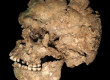  Left lateral view of the Qafzeh 25 skull from Qafzeh Cave, Israel. Researchers identified a healed sharp-force injury to the mandible, providing one of the earliest known examples of survived facial trauma in Homo sapiens