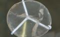 The Nimrud lens or Layard lens is a 3000-year old piece of rock crystal, which was unearthed by Austen Henry Layard at the Assyrian palace of Nimrud, in modern-day Iraq. (Source: Wikipedia)