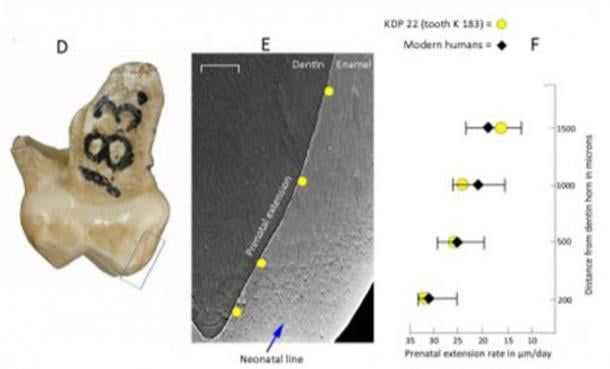 El estudio reciente, basado en cinco dientes de leche encontrados en el sitio de Krapina en Croacia, reveló que el desarrollo del niño neandertal fue más rápido que el proceso de maduración en los humanos modernos. (Patrick Mahoney et al / La Sociedad Real)