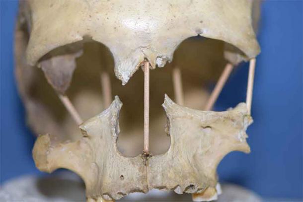 El estudio genético incluye la secuencia completa del genoma de una mujer que vivió hace 35.000 años, extraído de un cráneo encontrado en Rumanía en la cueva Peştera Muierii. (Mattias Jakobsson / Universidad de Uppsala)