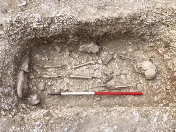A child buried with a Chatelaine or purse in the Saxon cemetery. (Operation Nightingale)