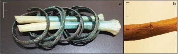 Amputated right hands, still with their bracelets (left side). And the rib of an individual showing a stab wound (T. Fernández-Crespo / Antiquity Publications Ltd)