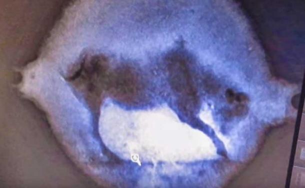 An x-ray image of a bronze disc found at the Antikythera ship wreck.
