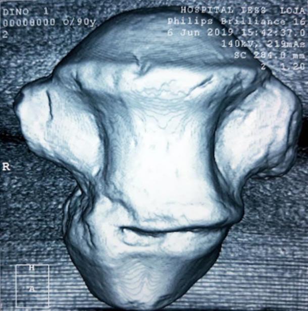 Analysis of one of the vertebrae. (El Universo)