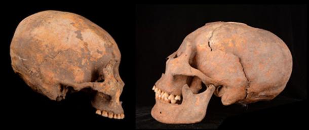 Artificially remodeled human skulls unearthed at a site in northeastern China include one of a man from around 12,000 years ago (left in this composite image) and another of a woman from about 5,000 years ago (right). (Zhang et al., American Journal of Physical Anthropology, 2019)