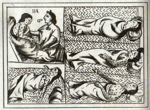 Sixteenth-century Aztec drawings of victims of smallpox, which like leprosy, was something that was brought from the Old World to the New World by European colonizers. (Public domain)