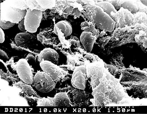 Bacteria Yersinia pestis