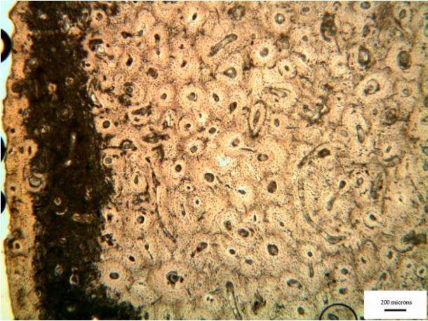 Bacterial tunnelling in a femur from Cladh Hallan. Tom Booth, Author provided