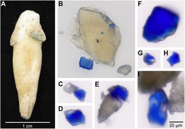 Blue particles observed embedded within archaeological dental calculus. (A) Archaeological tooth from individual B78 showing attached dental calculus deposits before sampling. Images (B) to (I) are shown to the same scale, as indicated in (I). Credit: C. Warinner (A); M. Tromp and A. Radini (B to I). (CC BY NC 4.0)