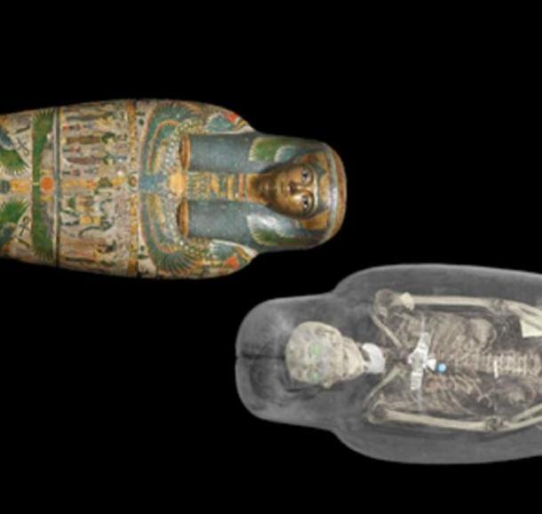 Imagen de tomografía computarizada de la momia.