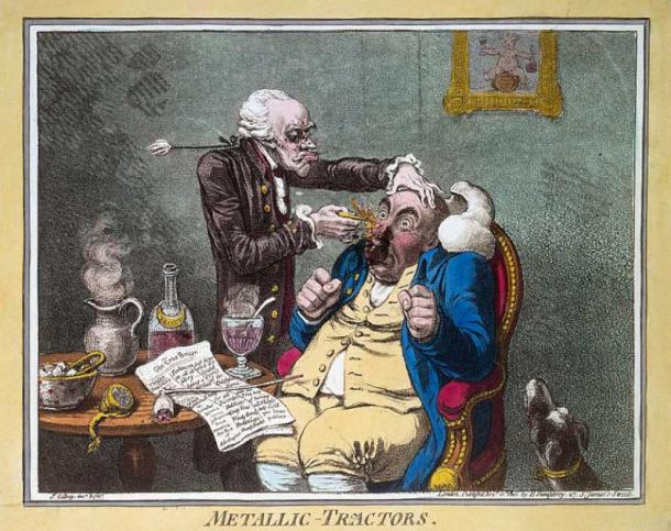 Caricature of a quack treating a patient with Perkins Patent Tractors by James Gillray, 1801. (Wellcome Images/CC BY 4.0)