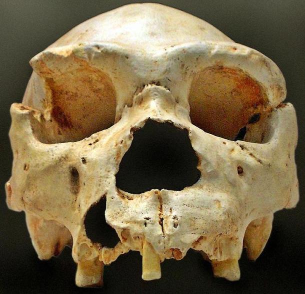 Cranium 5