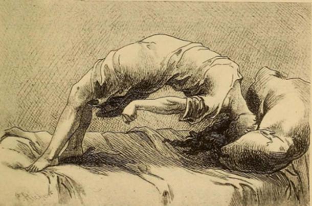 Demonic possession as a result of hysteria, 1858. (Fæ / Public Domain)