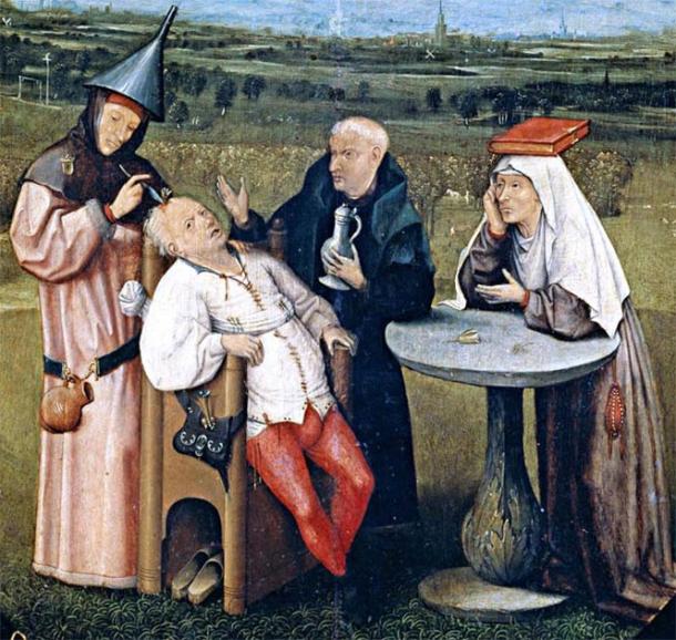 Depiction of ancient brain surgery. (Hieronymus Bosch / Public domain)