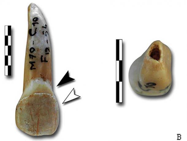 Detail of partly digested teeth.