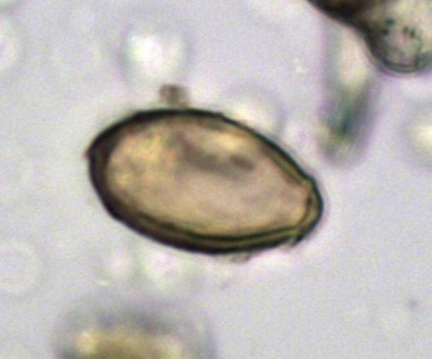Egg of Chinese liver fluke discovered in the latrine at Xuanquanzhi, viewed using microscopy. Dimensions 29 x 16 micrometers. The Journal of Archaeological Science