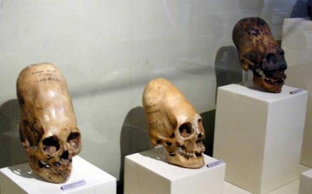 Elongated skulls on display at Museo Regional de Ica in the city of Ica in Peru.