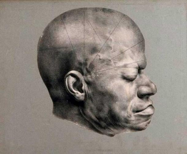 Death mask of Eustache, a slave from the Dominican Republic who came to be awarded a 'prize for virtue' in 1830's Paris. Lithograph, c. 1835. (Public Domain). Eustache’s death mask was used in the study of phrenology. The lines drawn across the head refer to the “bumps” through which an individual’s character and abilities are studied.