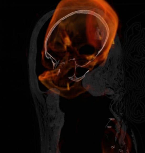 Another scan of Hatason’s head.