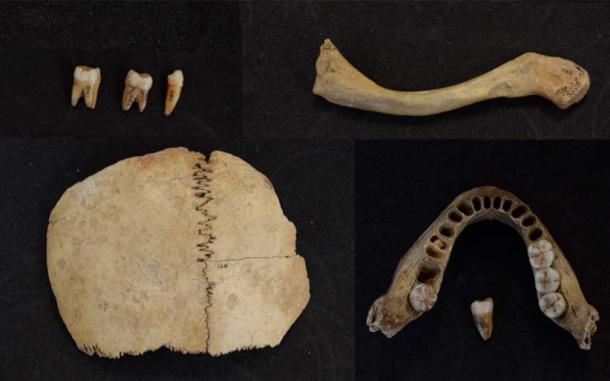 Human teeth, jaw, and other remains from Kendrick’s Cave dated to approximately 13,600 year ago. DNA was analysed from this individual (R. Stevens / Nature)