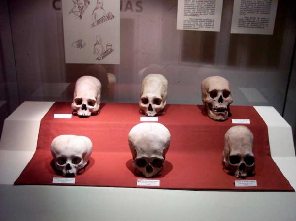 Intentional skull deformation or head shaping was common in several pre-Inca cultures. Some of these were also ‘finger painted’ with various red pigments. (Robrrb / CC BY SA 3.0)